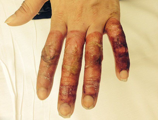 ? ?? ??, ??? ?? ? ??? ????